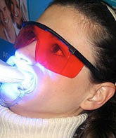 Load image into Gallery viewer, Teeth Whitening
